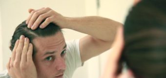 5 Easy Home Remedy Tips For Treating Dandruff In A Week