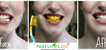 Turmeric: Find Out How I Whitened My Teeth Without Going To The Doctor